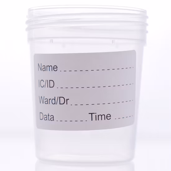 Amostra descartável 60ml Recipiente de urina vermelha para hospital